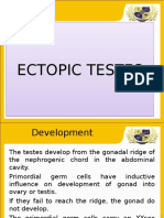 Ectopic Testis