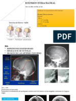 Hipertensión Intracraneal