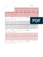 Ekg Practice