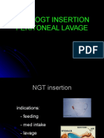 NGT Peritoneal Lavage