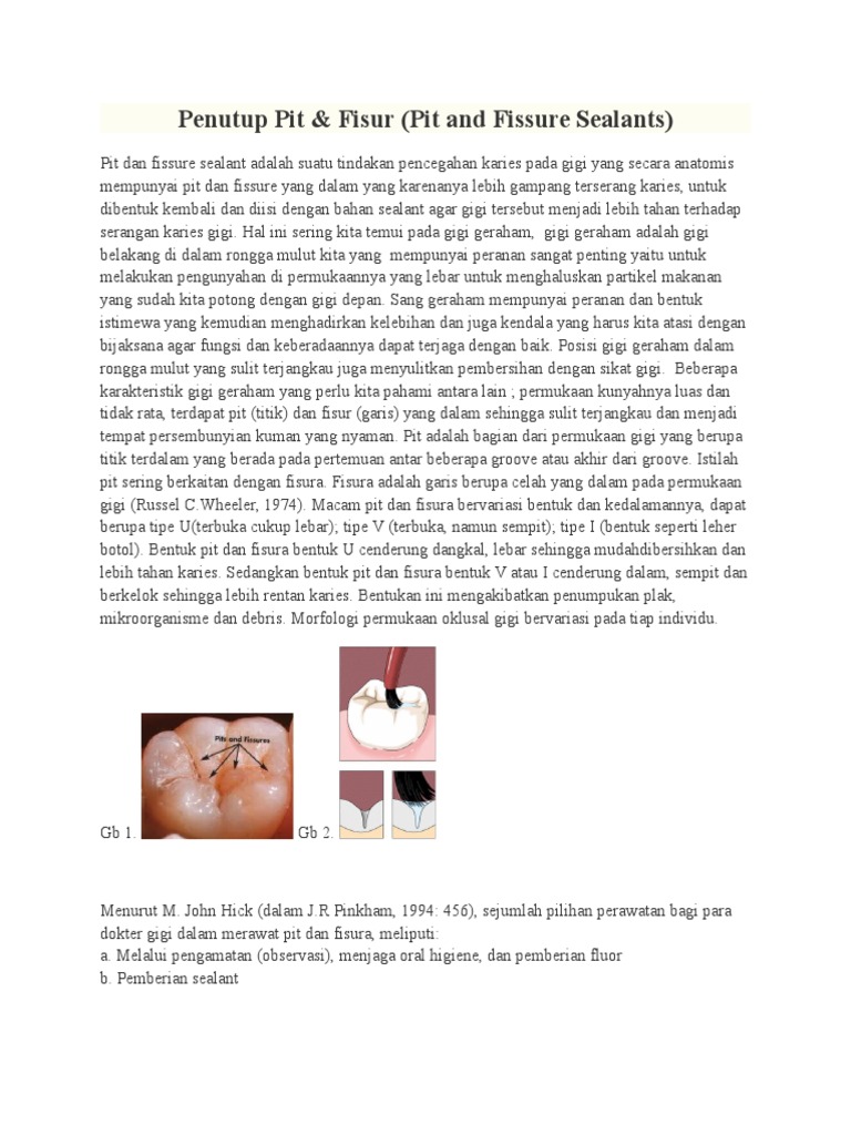 Pit and Fissure Sealant | PDF