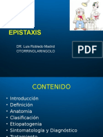 Epistaxis