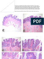 Histologi Nevus Epidermal