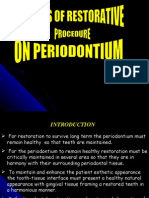 Effects of Restorative Procedure On Um Perio