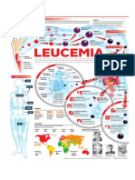 Leucemia PDF