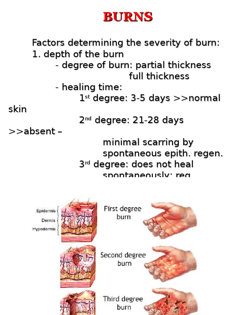 Burns PDF Burn Kidney