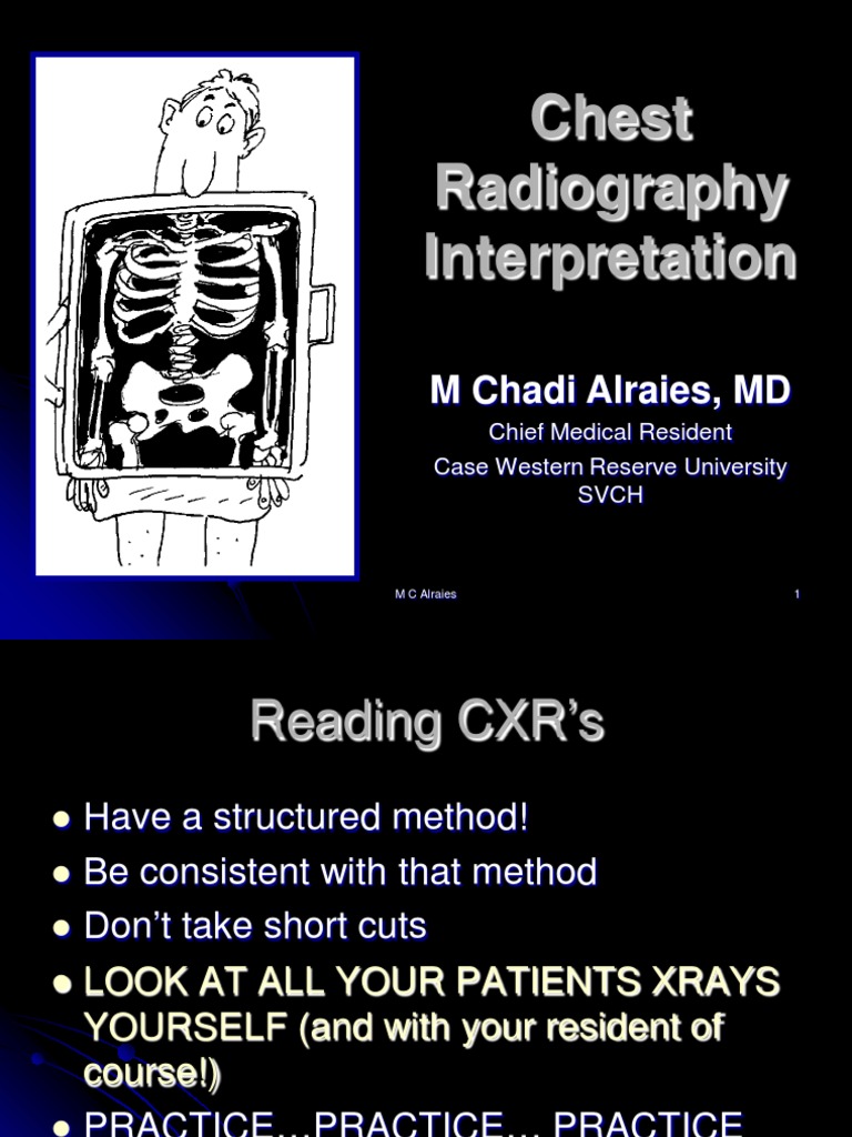 Chest X Ray Made Easy | PDF | Lung | Respiratory System