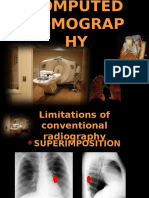 COMPUTED TOMOGRAPHY - Pps