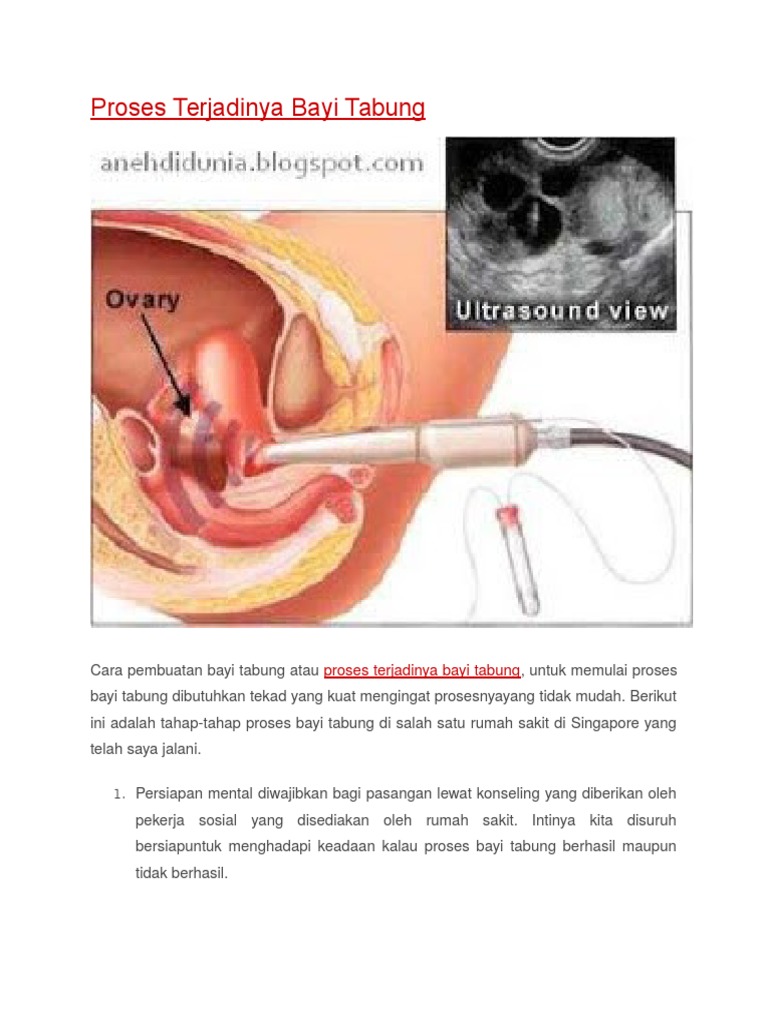 Proses Terjadinya Bayi Tabung