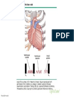 Pericardial Friction Rub