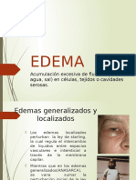 EDEMA.pptx