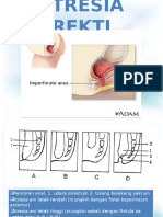 Atresia Rekti