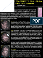 Foliculite - LED