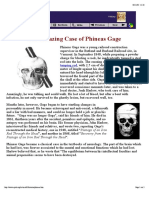 The Amazing Case of Phineas Gage: Projected The Tamping Rod