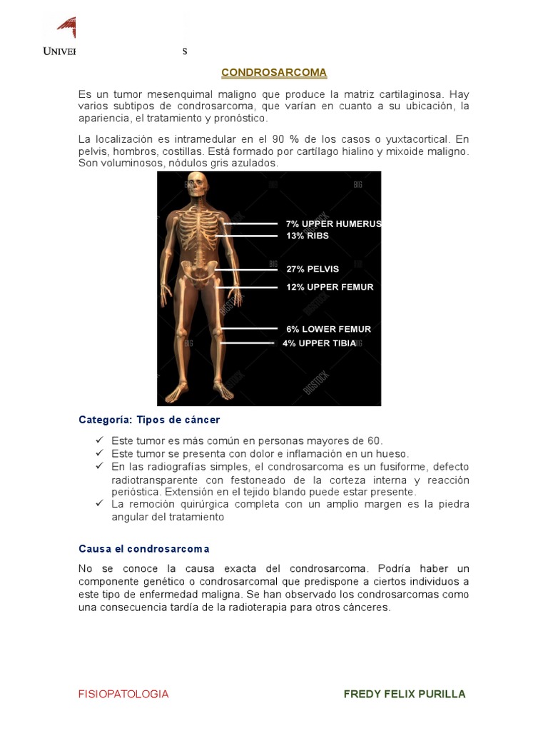 El Condrosarcoma | Hueso | Cartílago