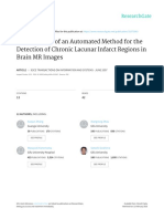 Development of an Automated Method for the Detection of ChronicLacunar Infarct Regions in Brain MR Images
