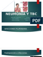 Neumonia y Tbc