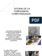 Historia de La Tomografia Computarizada