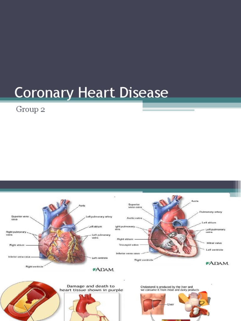 Coronary Heart Disease | PDF | Coronary Artery Disease | Atheroma