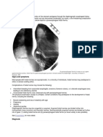 Hiatal Hernia