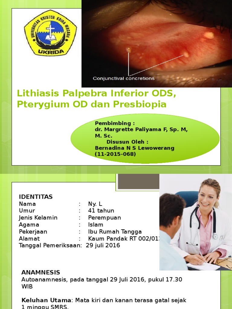 Diagnosis dan Penanganan Lithiasis Mata | PDF