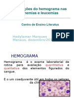 2_alterações Do Hemog Anemias e Leucemias