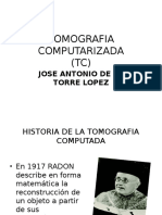 Tomografia Computarizada