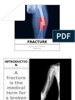 Fracture: Edfran Jed A. Serino MSN 303
