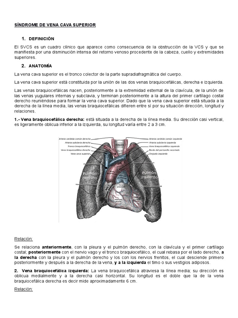 sindrome-de-vena-cava-superior-pdf-c-ncer-de-pulm-n-aorta