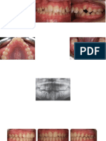 Clinical cases