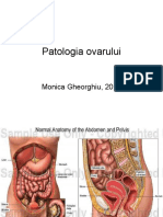 9patologia-ovarului (1)