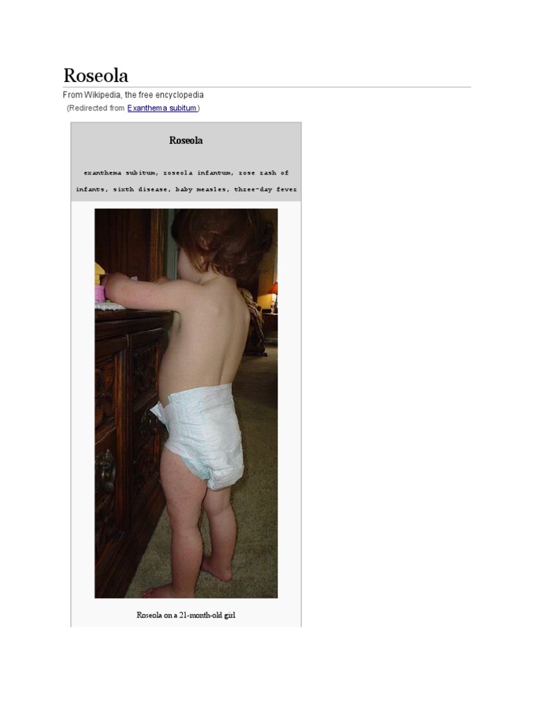 Roseola PDF Epidemiology Immunology