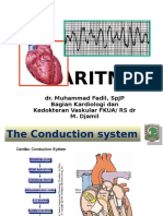 ARITMIA