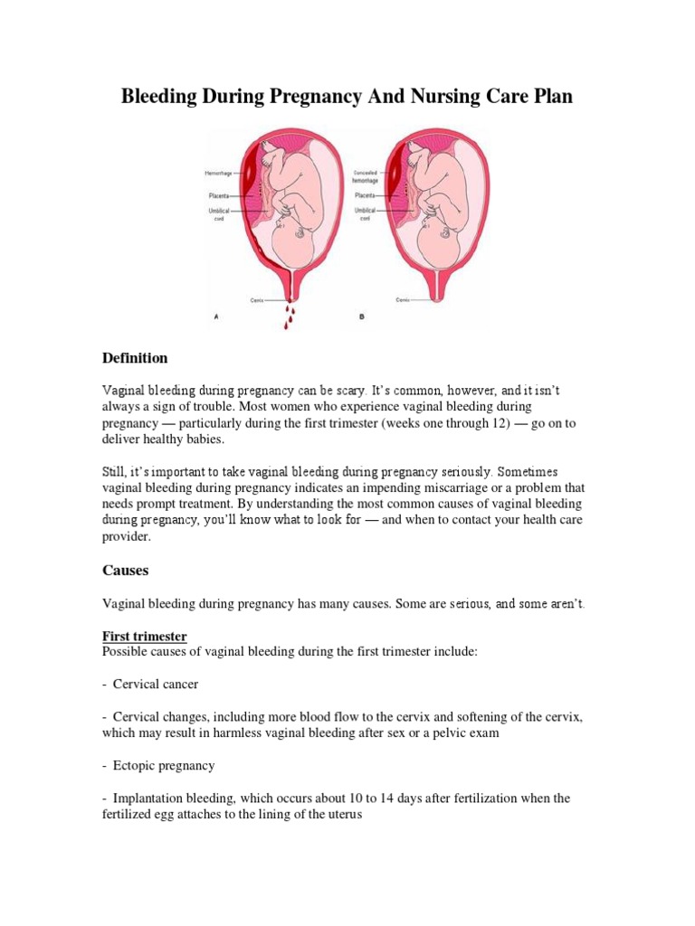 Bleeding During Pregnancy And Nursing Care Plan Childbirth
