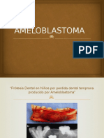 Prótesis Dental Niños Ameloblastoma