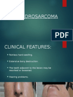 chondrosarcoma osski.pptx