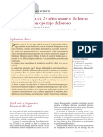 12 Caso Clínico. Paciente Varón de 25 Años Usuario de Lentes de Contacto Con Ojo Rojo Doloroso