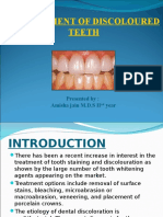 Management of Discoloured Teeth: Presented By: Amisha Jain M.D.S II Year