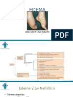 4. Edema Renal y Hepatico