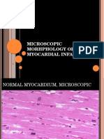 Microscopic Morphology Myocardial Infarction