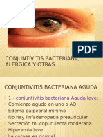 2. Conjuntivitis Bacteriana, Alérgica y Otras (ALE)