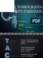 Tomografia Computarizada