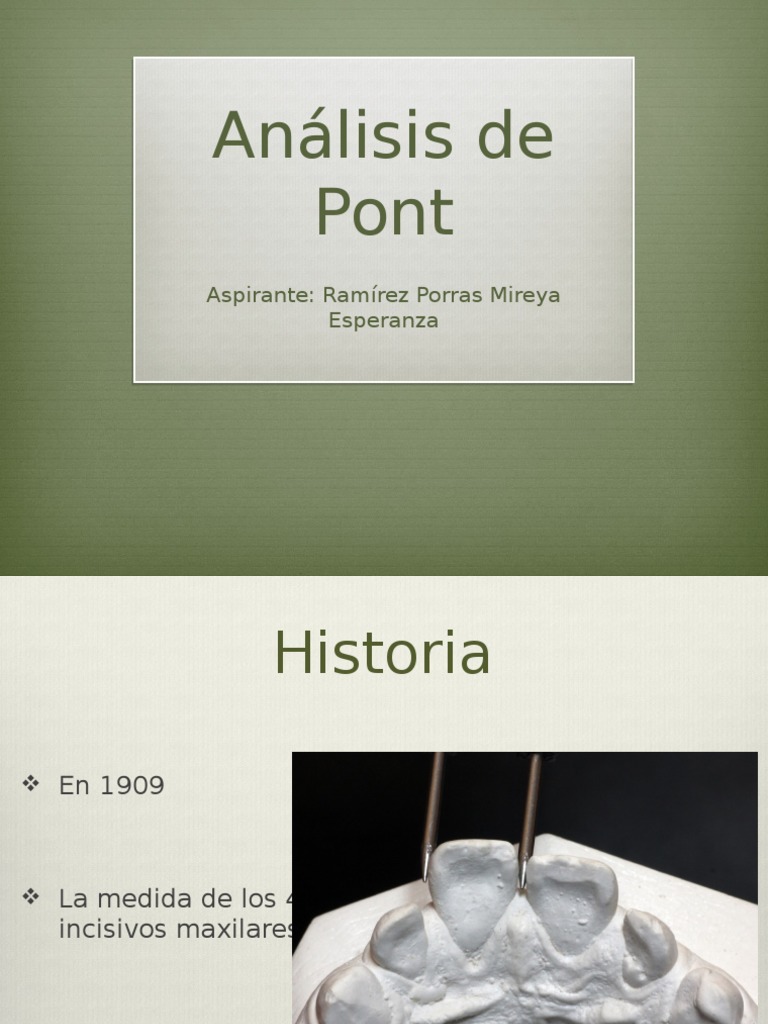 Análisis de Pont | PDF