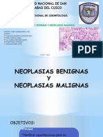 Neoplasias orales: benignas vs malignas