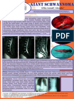 Schwannoma