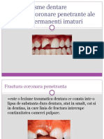 Fracturi Coronare Penetrante Ale Dintilor Permanenti Imaturi