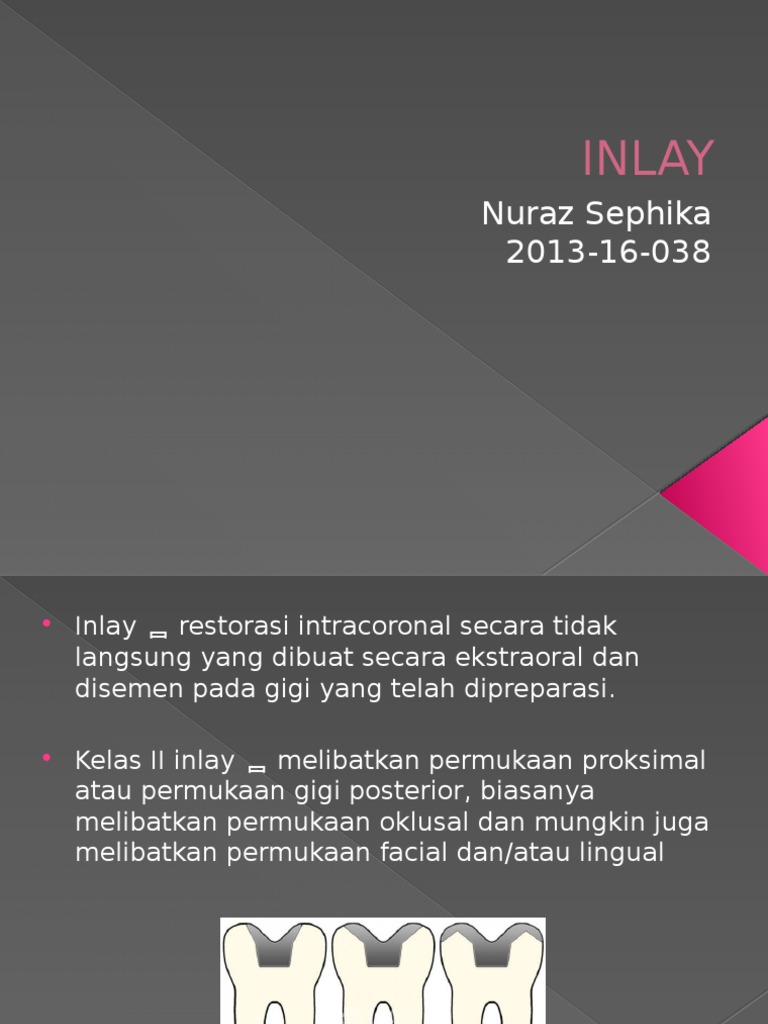 Inlay | PDF