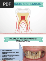 Download PPT kesehatan gigi lansiappt by monik SN325552922 doc pdf