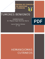 TUMORES BENIGNOS