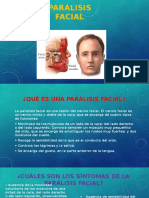 Parálisis Facial